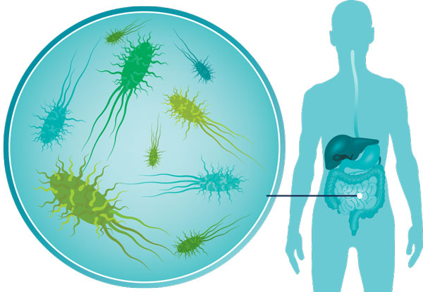 Your body bugs may be causing your ill health